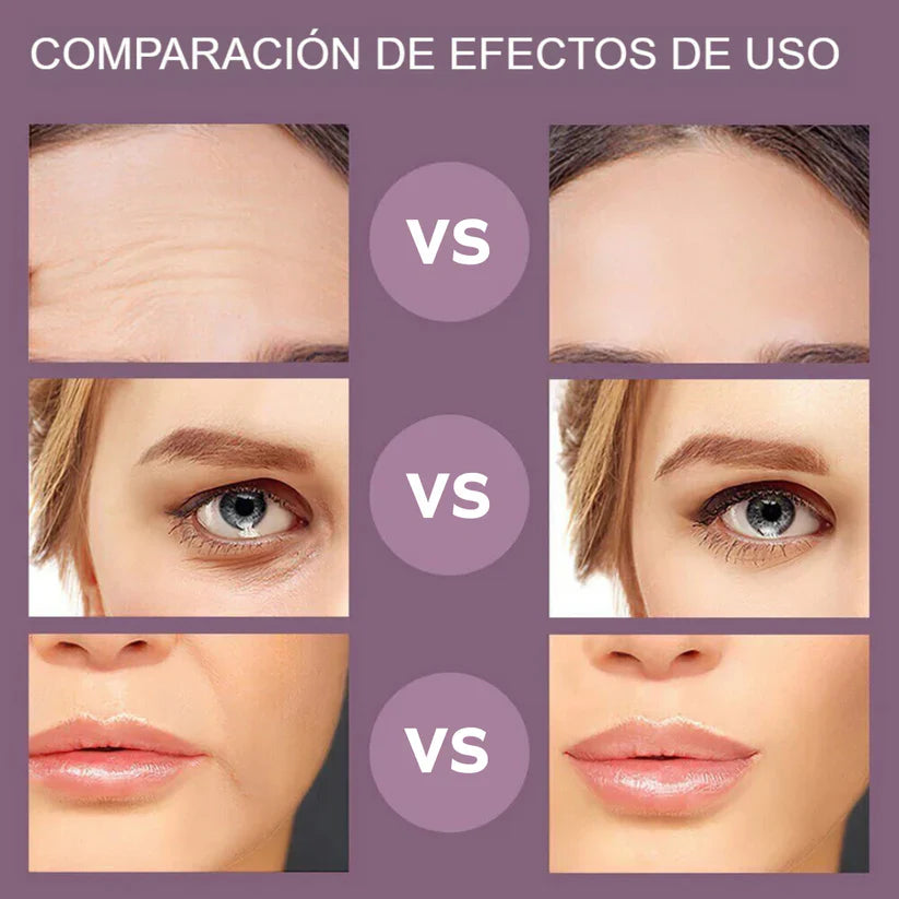 MASAJEADOR FACIAL MICROCORRIENTE